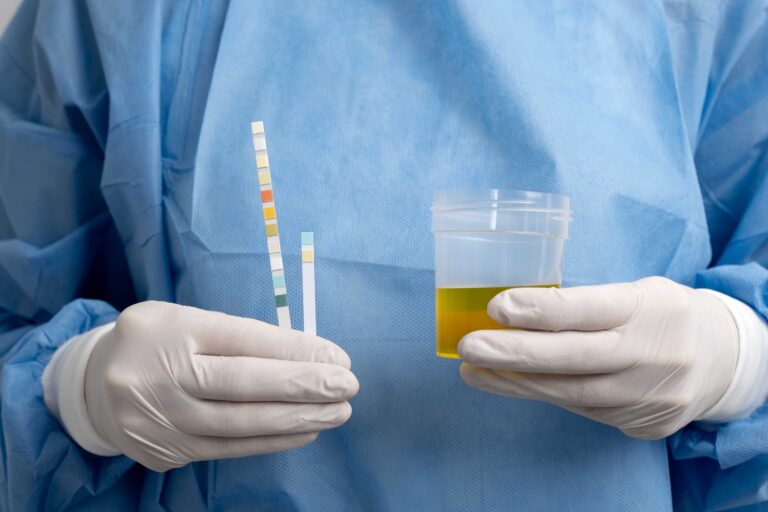 Hematuria: cuando la orina da una señal de alerta